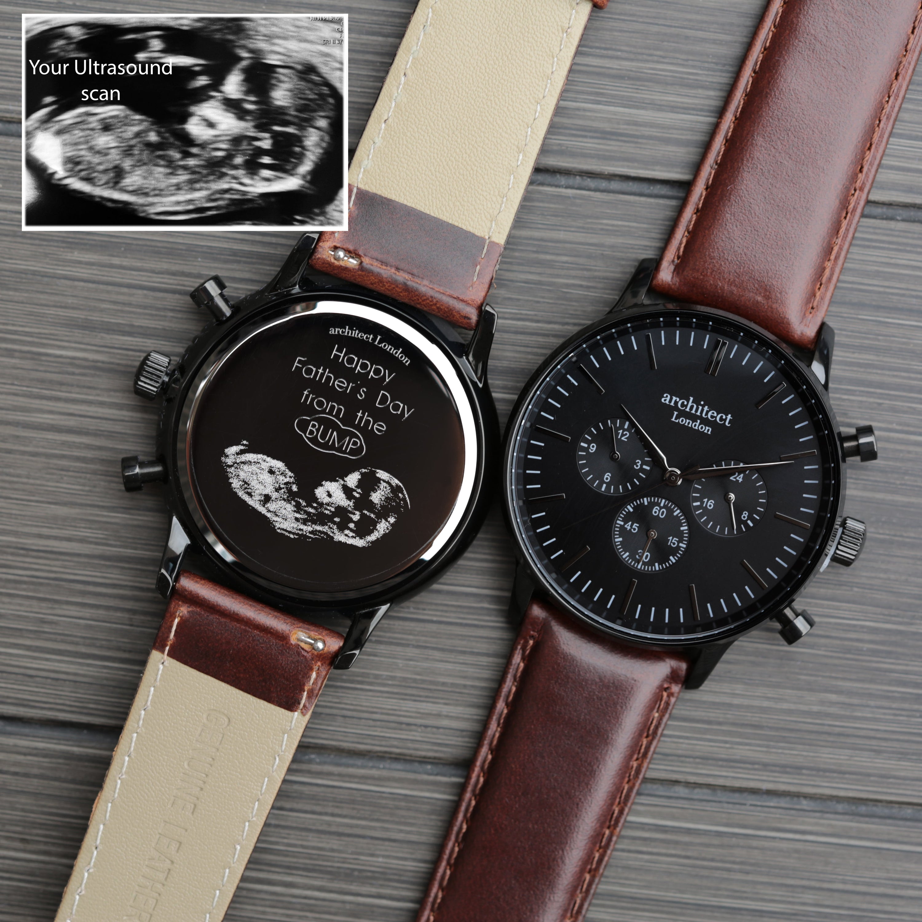 Two watches with brown straps on a textured surface, one showing an ultrasound scan inset.